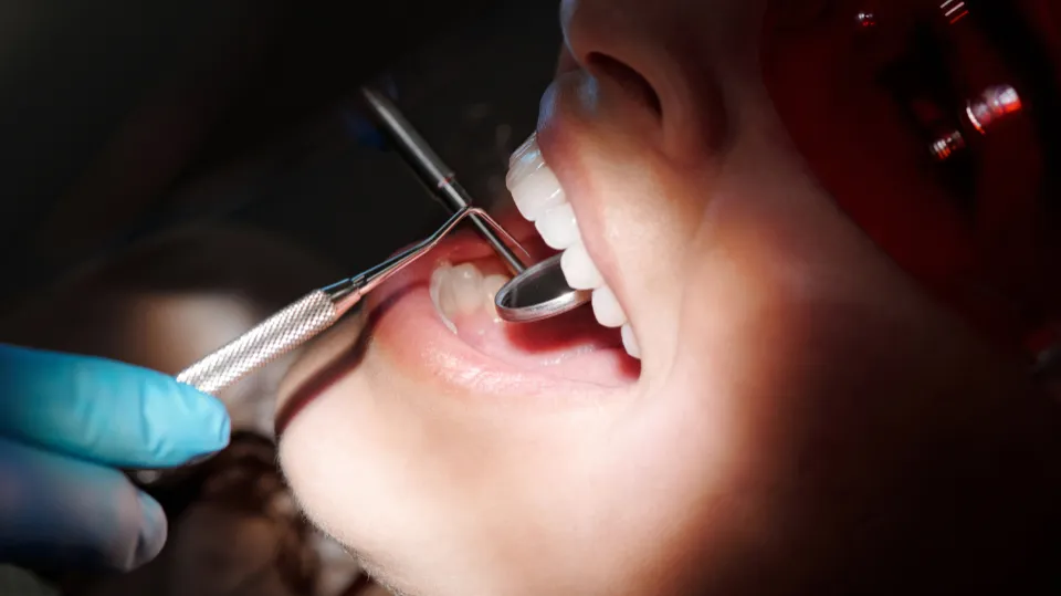 How long does a root canal take? | How do I know if I need a root canal?