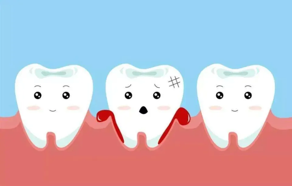 Can A Loose Tooth Be Fixed - Causes & How to Strengthen