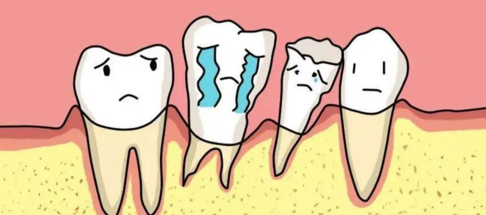 Can A Loose Tooth Be Fixed - Causes & How to Strengthen