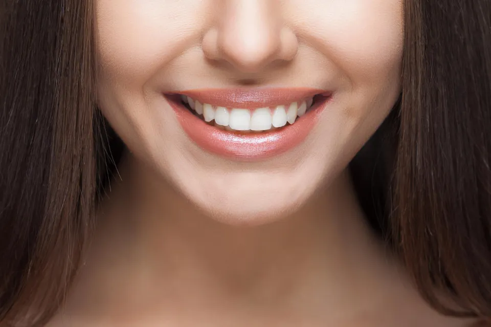 How Long Does It Take Braces to Work - When Can I See The Result?