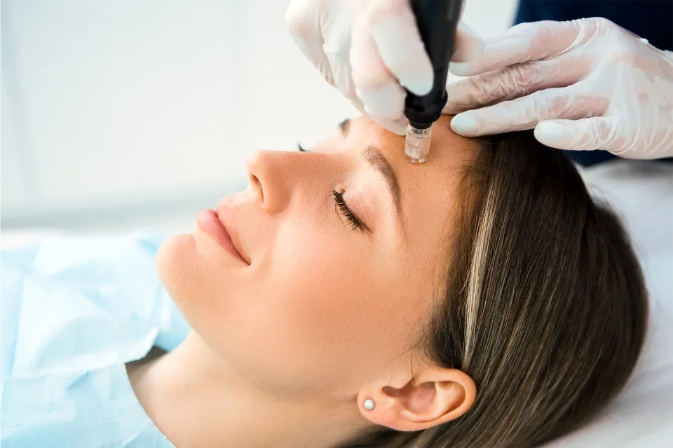 How Often Should You Microneedle - Microneedling at Home