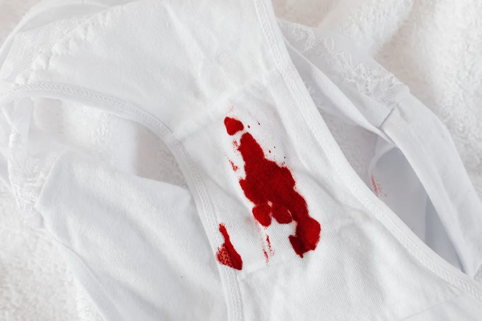 Stringy Period Blood: What Does It Mean & Is It Normal?