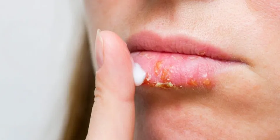 Vaseline for Chapped Lips - Is It Really Work?