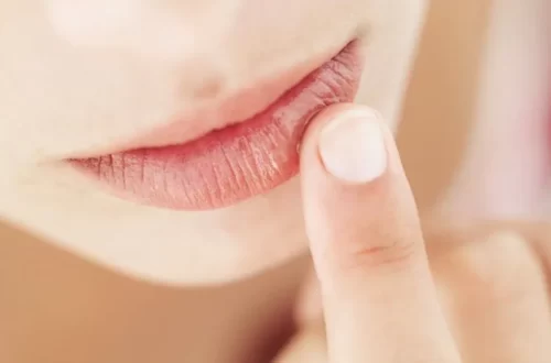 Vaseline for Chapped Lips - Is It Really Work?