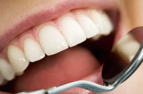 How Long Can Cavities Untreated - Everything You Should Know