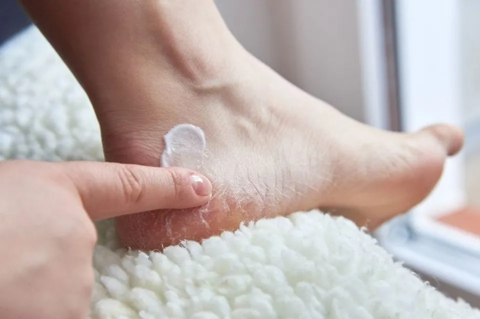Is Vaseline Good for Dry Feet - Soothing the Soles