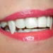 Sharp Canine Teeth Attractive - Exploring Dental Aesthetics